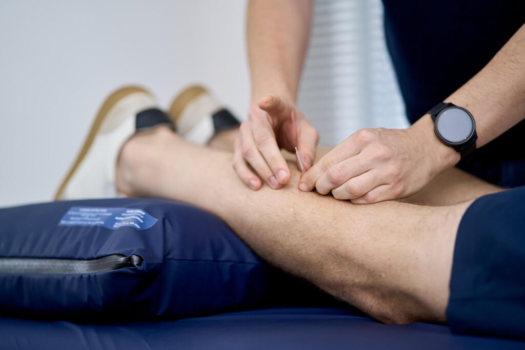 Dry Needling or Acupuncture…
